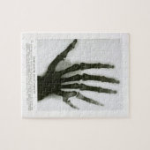 6つの指手のパズルのX線 ジグソーパズル (横)