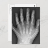 6つの指手、医学の珍事、X線 ポストカード (正面/裏面)