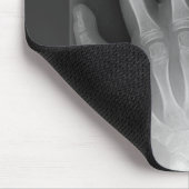 6つの指手、医学の珍事、X線 マウスパッド (コーナー)