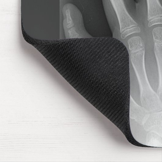 6つの指手、医学の珍事、X線 マウスパッド (コーナー)