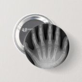 6つの指手、医学の珍事、X線 缶バッジ (正面&裏面)