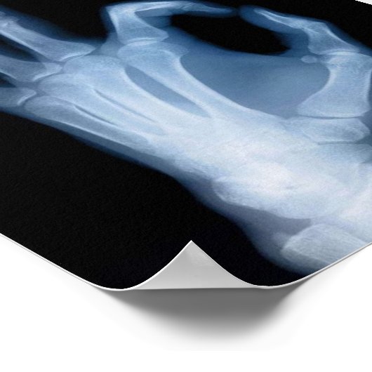 A-OK X線 ポスター (角)