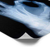 A-OK X線 ポスター (角)