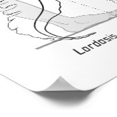 Abnormal Curves of the Spine Poster Chiropractic ポスター (角)