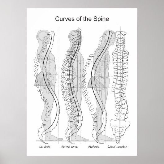 Abnormal Curves of the Spine Poster Chiropractic ポスター (正面)