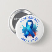 Acromegaly Awareness Ribbon 缶バッジ (正面&裏面)
