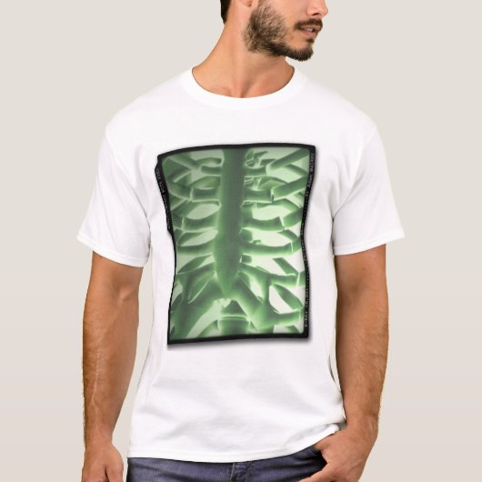 ACWEの携帯用胸部レントゲン Tシャツ (正面)