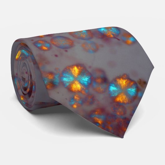 Asteroid hyalosis (polarization microscopy) ネクタイ (ロール)