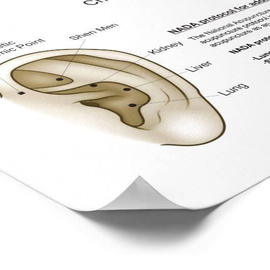 Auriculotherapy Ear Acupuncture ポスター (角)