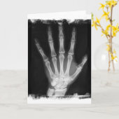 B&WのX線の骨組手 カード (黄色い花)