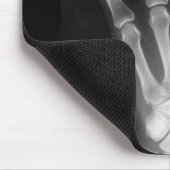 B&WのX線の骨組手 マウスパッド (コーナー)