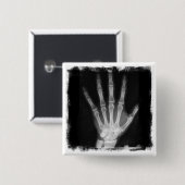 B&WのX線の骨組手 缶バッジ (正面&裏面)