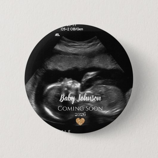 Baby Coming Soon Ultrasound Gold heart  缶バッジ (正面)