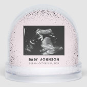 Baby Ultrasound | Sonogram Pregnancy Announcement (正面)