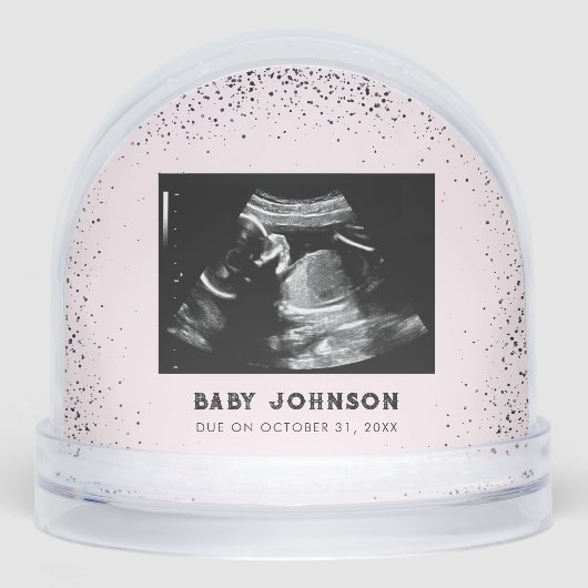 Baby Ultrasound | Sonogram Pregnancy Announcement (正面)