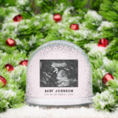Baby Ultrasound | Sonogram Pregnancy Announcement (クリスマス)