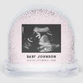 Baby Ultrasound | Sonogram Pregnancy Announcement (裏面)