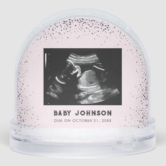 Baby Ultrasound | Sonogram Pregnancy Announcement (裏面)