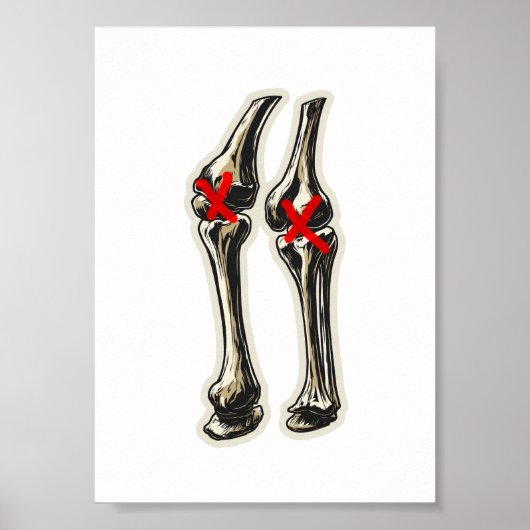 Bad Knees – Funny Skeleton Knee Illustration ポスター (正面)