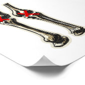 Bad Knees – Funny Skeleton Knee Illustration ポスター (角)