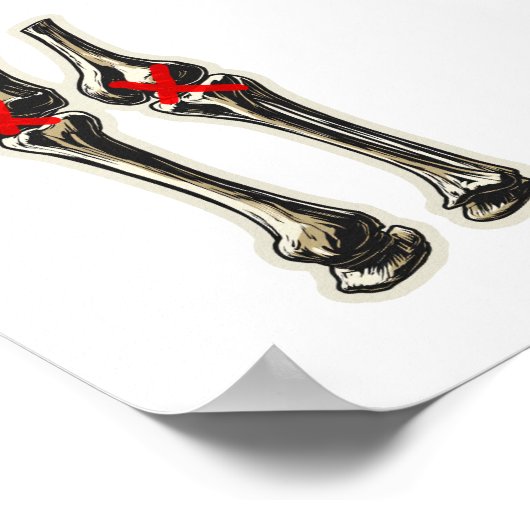 Bad Knees – Funny Skeleton Knee Illustration ポスター (角)