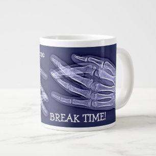 Broken Finger Xray 「Break Time」(おもしろい指のX線の「Break T ジャンボコーヒーマグカップ