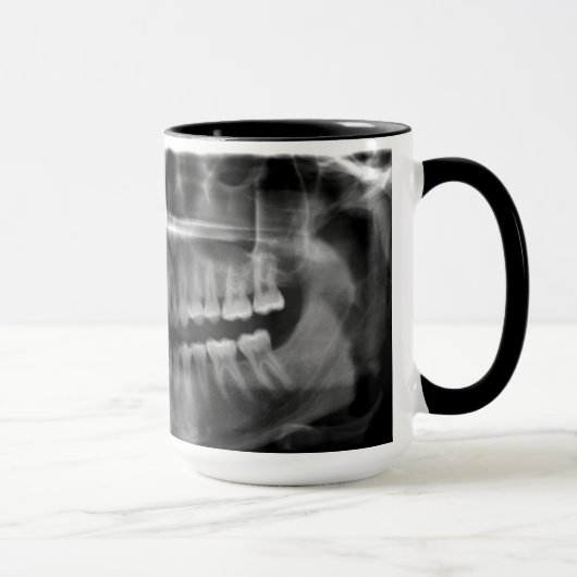 Caneca Radiografia Panoramica マグカップ (右)