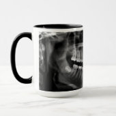 Caneca Radiografia Panoramica マグカップ (左)