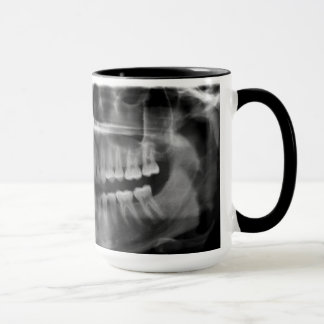 Caneca Radiografia Radiologia マグカップ