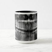 Caneca Radiografia Radiologia マグカップ (中央)
