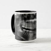 Caneca Radiografia Radiologia マグカップ (正面左)