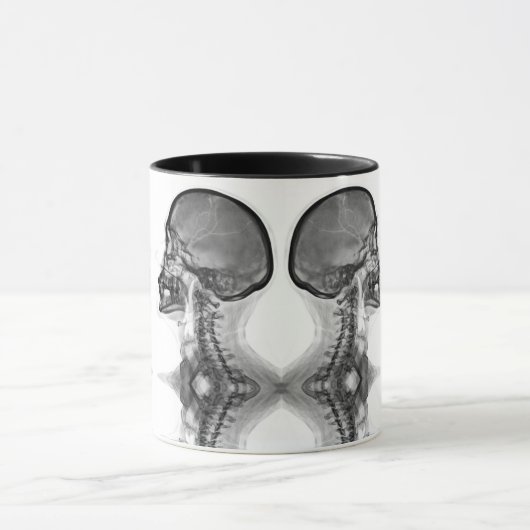 Caneca Radiologica マグカップ (中央)