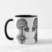 Caneca Radiologica マグカップ (左)
