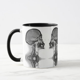 Caneca Radiologica マグカップ