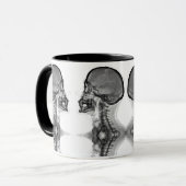 Caneca Radiologica マグカップ (正面左)