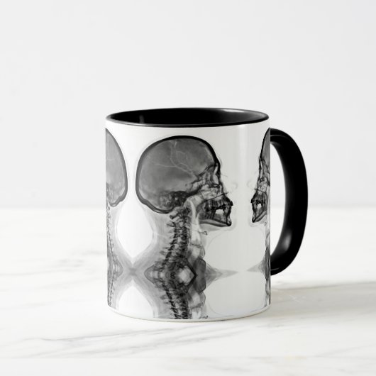 Caneca Radiologica マグカップ (正面右)
