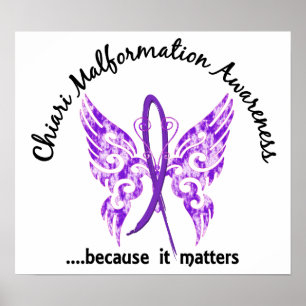 Chiari Malformation Butterfly 6.1 ポスター