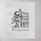 Chiropractic Vertebral Subluxation Vintage Print ポスター (正面)