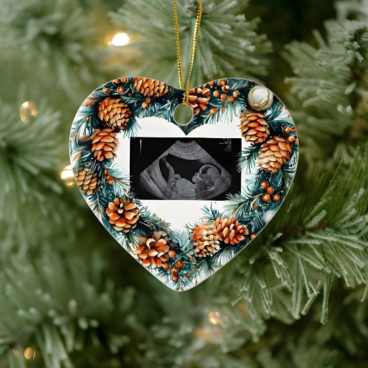 Christmas Pregnancy Ultrasound  Baby On The Way  セラミックオーナメント