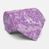 CMV Endocervicitis ネクタイ (ロール)