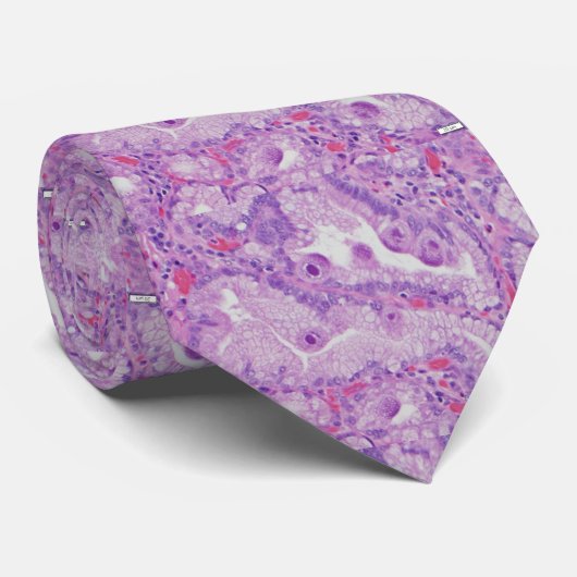 CMV Endocervicitis ネクタイ (ロール)