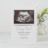 Coming Soon Baby Scan Pregnancy 案内状 (スタンド正面)