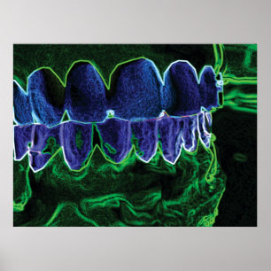 Cool Teeth Model Dentist Orthodontist Poster ポスター