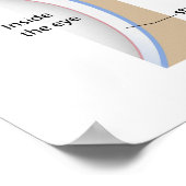 Corneal ulcer eye condition Poster ポスター (角)