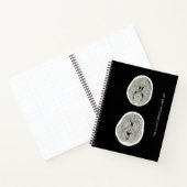 CT Scan_CTFOD_うつ病の様子 ノートブック (内部)