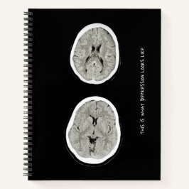 CT Scan_CTFOD_うつ病の様子 ノートブック
