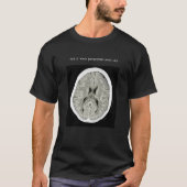 CT Scan_ CTFOD_うつ病の様子 Tシャツ (正面)