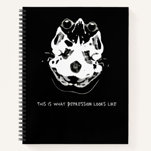 CT Scan_CTFOD_CODピエロ ノートブック (正面)