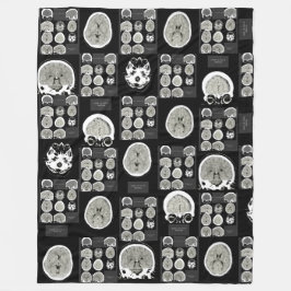 CT Scan_this is depression_BLK_CTFOD フリースブランケット