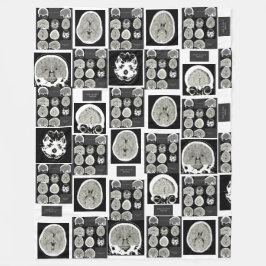 CT Scan_this is depression_CTFOD フリースブランケット